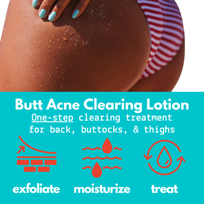 Green Heart Labs Skin Care Hero Duo | Butt Acne Clearing Lotion + CocoLube, 4 oz *LIMITED EDITION*